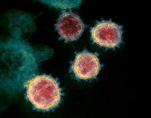 615px-Novel_Coronavirus_SARS-CoV-2